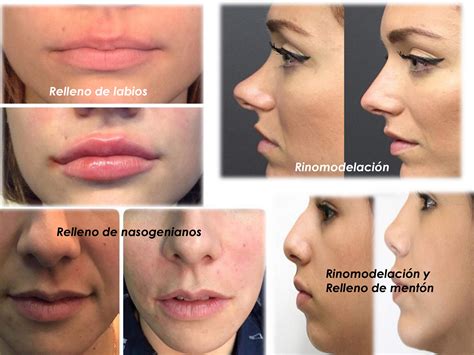 Cosmetic Surgery – Dental Bio-Esthetics