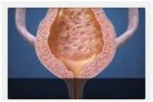 neurogenic bladder  coimbatore id