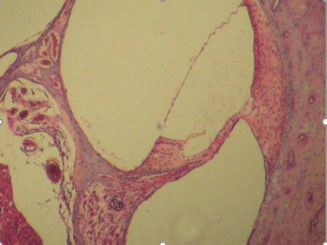 Ear Histology Diagram | Quizlet