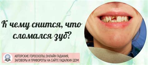 Сонник: сломался зуб