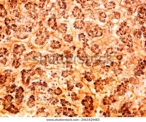pancreatic acini cells images stock   objects vectors