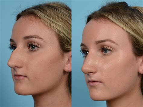 Trey Gowdy's Nose: The Before & After Photos You Won't Believe! Image 17