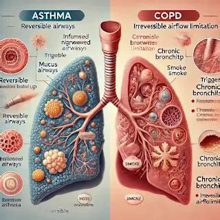 Asthma vs COPD overview