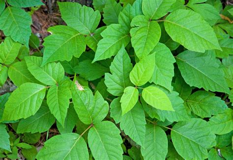 poison ivy treatment home remedy 8