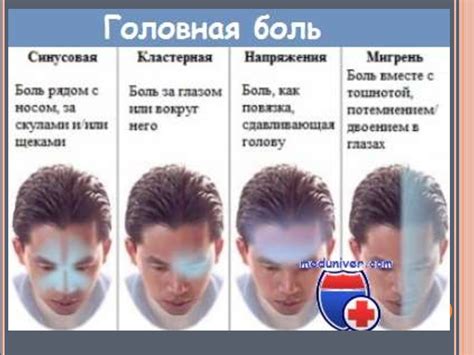 Кластерная головная боль - презентация онлайн