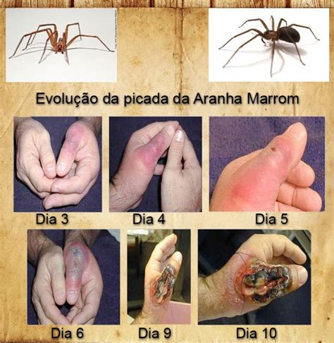 Picada de Aranha Marrom: Sintomas, Tratamento - Encontros Pet