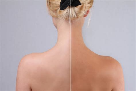 Autobronzeador Antes E Depois - Dicas para aplicar corretamente o autobronzeador