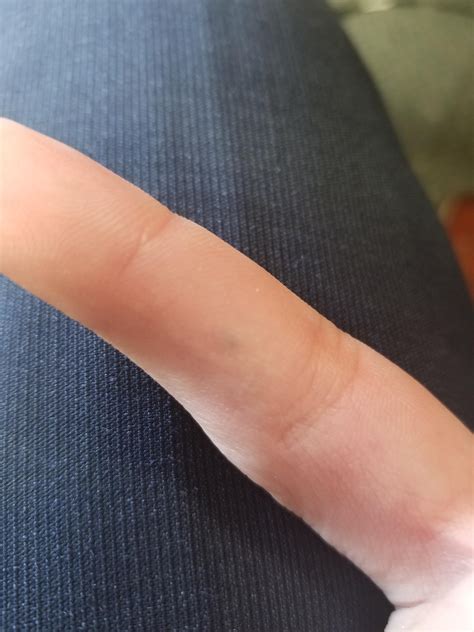 What's this tiny dark spot on my index finger, I know I may be