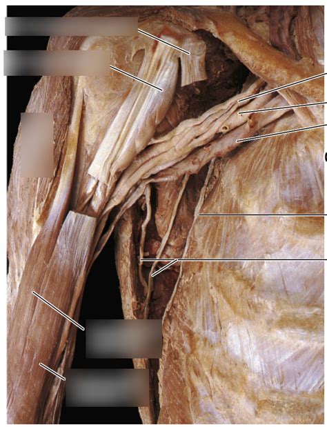 virtual anatomy upper extremity  diagram quizlet
