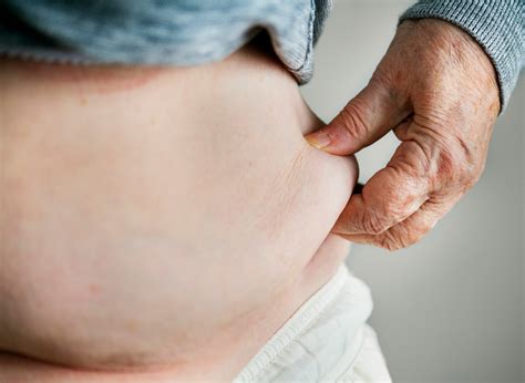 Belly Fat and Gut Connection | Kim Nick
