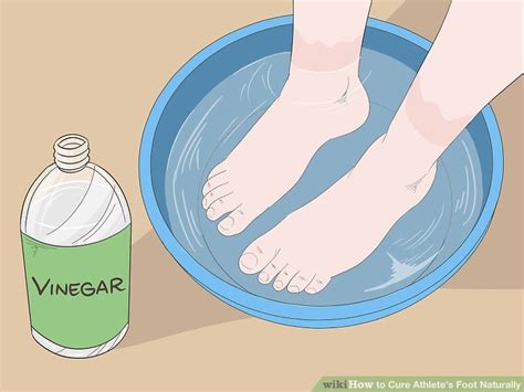 how to cure athlete's foot at home