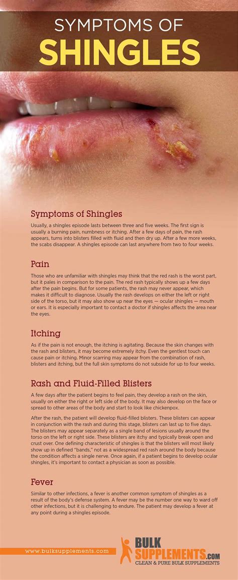 How Long Does Shingles Last How To Treat Shingles