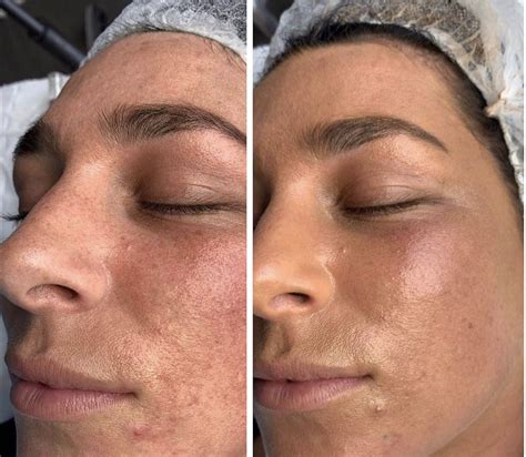 bb glow  ultimate guide