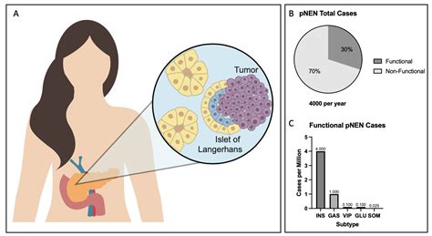 Models in Pancreatic Neuroendocrine Neoplasms: Current Perspectives and