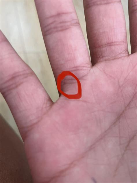 Small hard bump under skin/inside hand? I noticed it yesterday when