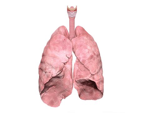 Catherine Chadha - Medical Artists’ Association of Great Britain