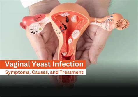 how to treat viginal yeast infection at home