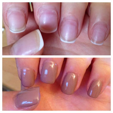 5 Sensitive Nails After Removing Acrylics - blogkece