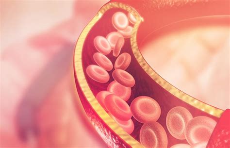 coronary artery ectasia heart matters magazine bhf