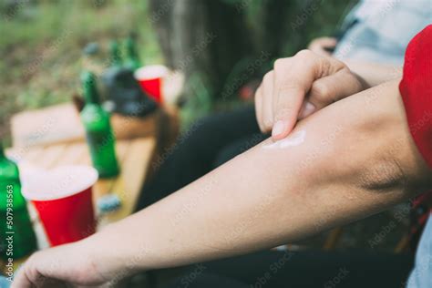 Insect bites and stings with hands Stock Photo | Adobe Stock