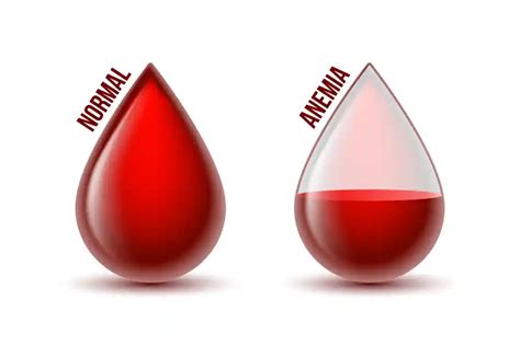 dangerously  hemoglobin levels  hemoglobin anti leukemia