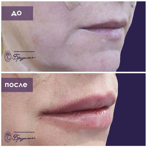 Фотографии до и после операций и косметических процедур