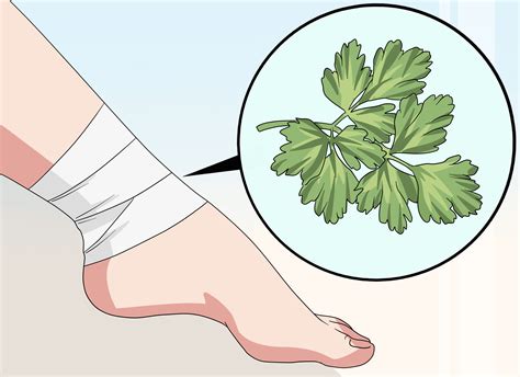 How to Heal a Bruise: 9 Steps (with Pictures) - wikiHow