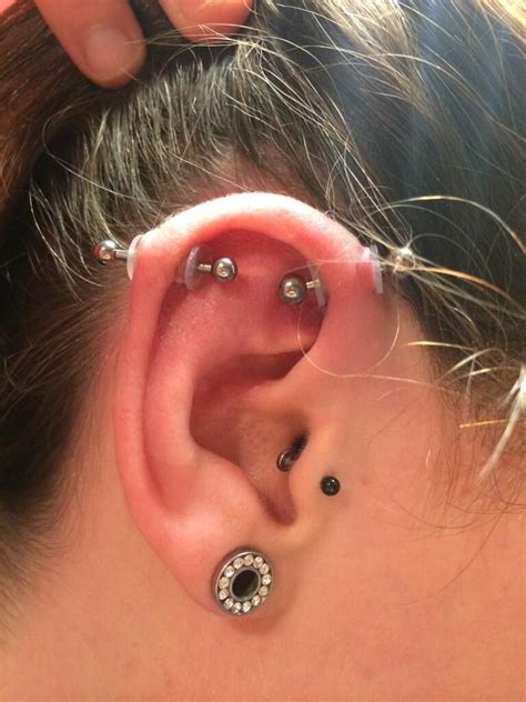 Hypertrophic Scar Piercing