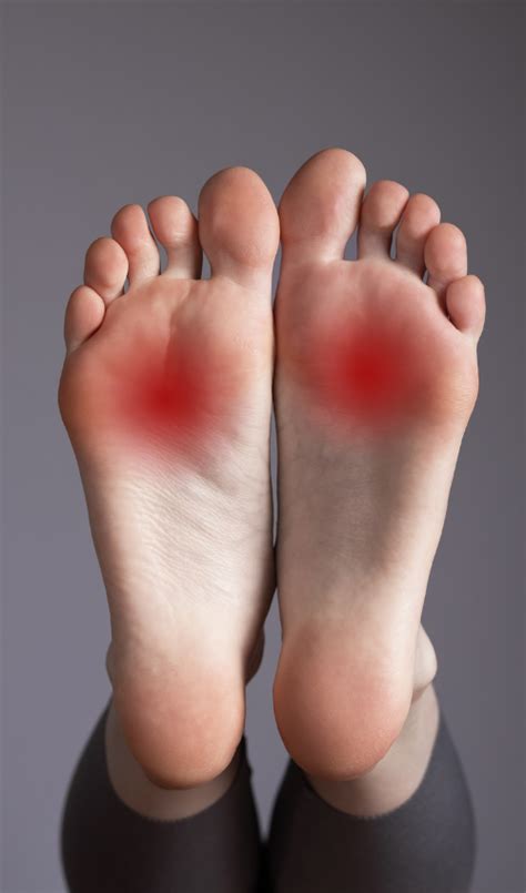 Morton's Neuroma. Symptoms and Best Treatments. – Bilt Labs
