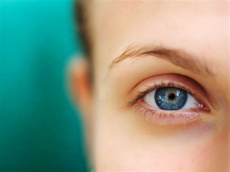 Ptosis: Droopy Eyelid Causes, Symptoms, and Treatment