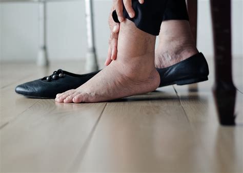 How to Prevent Amputation | Next Step Foot & Ankle Clinic