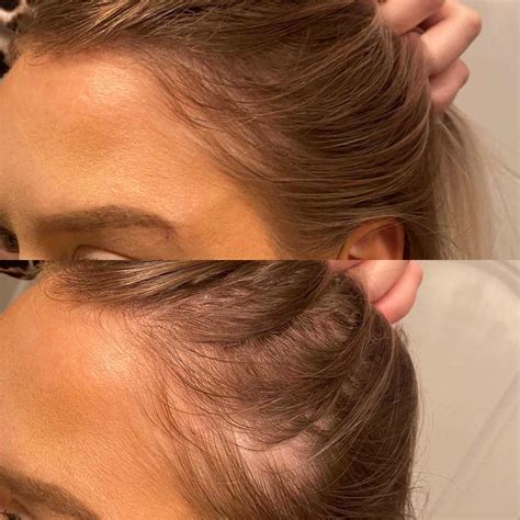 how to apply vegamour hair serum