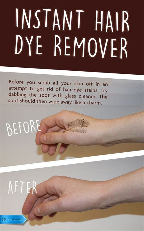6 Hacks To Rescue Your Skin From Dyeing Disaster
