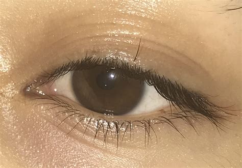 This eyelash I have growing on my eyelid. : r/mildlyinteresting