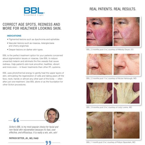 Laser Therapies | Medical Age Management