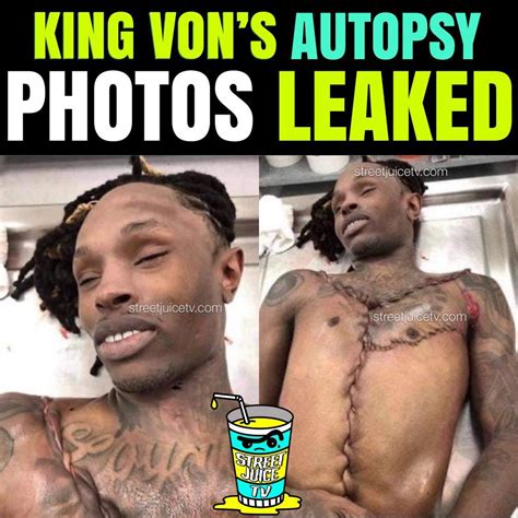 King Von Morgue: Uncovering The Tragic Details