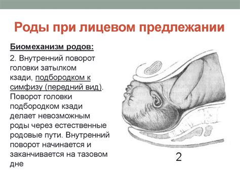 Разгибательные предлежания головки плода: переднеголовное, лобное ...