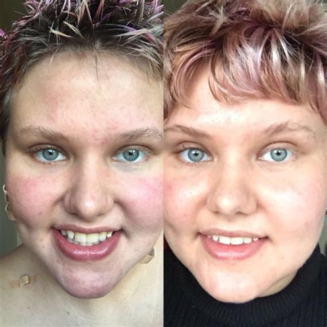 [Celeb Name]'s Night Out: Before And After Photos That Will SHOCK You (Phun Celeb Extras Exclusive) Image 17