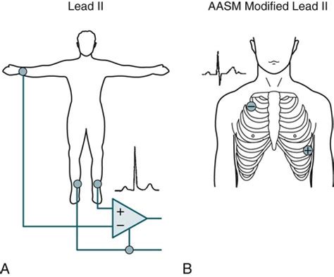 cardiac monitoring  polysomnography neupsy key