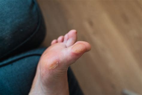 Foot and Ankle Nerve Pain | Foot Neuritis | The Foot Practice