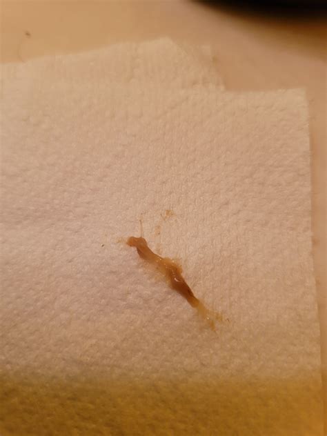After just peeing, wiped this off my anus. Dr. said I have pinworms