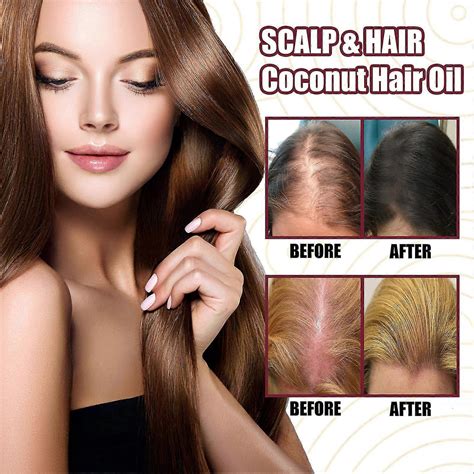 Onion Hair Growth Spray With Healthy Herbal Formula Spray For Stronger