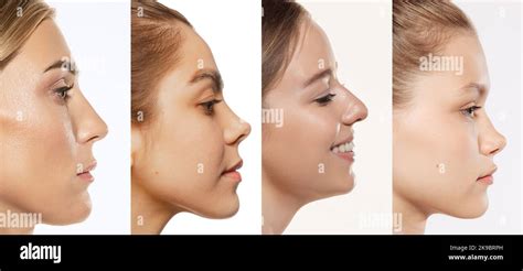 face building closeup portraits  women female chin cheeks  nose