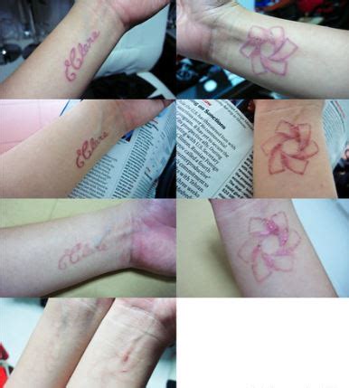 tattoo healing - Allure Clinic