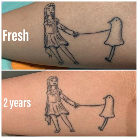 fine line after 5 years 1