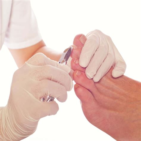 Foot Health Practitioner, Nail, Hard Skin, Corns, Calluses, Verrucas