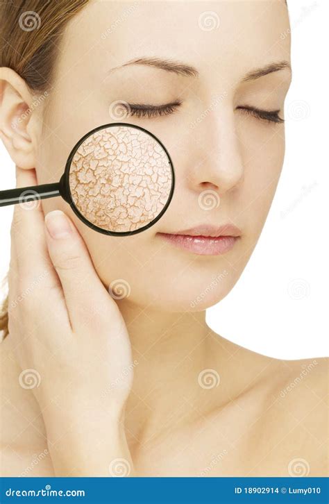Cracked Skin Royalty-Free Stock Image | CartoonDealer.com #18902914