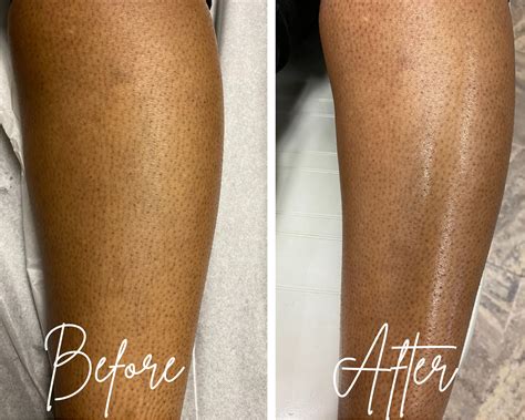 How To Exfoliate Legs Before Waxing at Gladys Roy blog