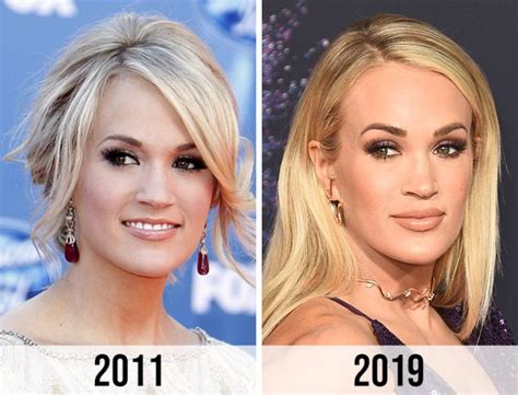 Has Carrie Underwood Had Plastic Surgery? A 2024 Perspective