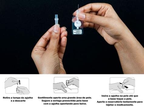 Quanto Tempo Dura A Injeção Anticoncepcional Para Cadelas - Injeção anticoncepcional | Tipos, vantagens e como tomar